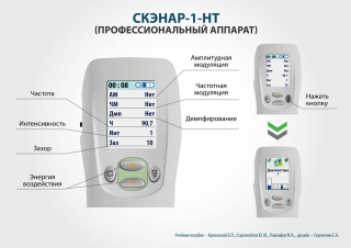 СКЭНАР-1-НТ (исполнение 01)  в Липецке купить Медицинская техника - denasosteo.ru 